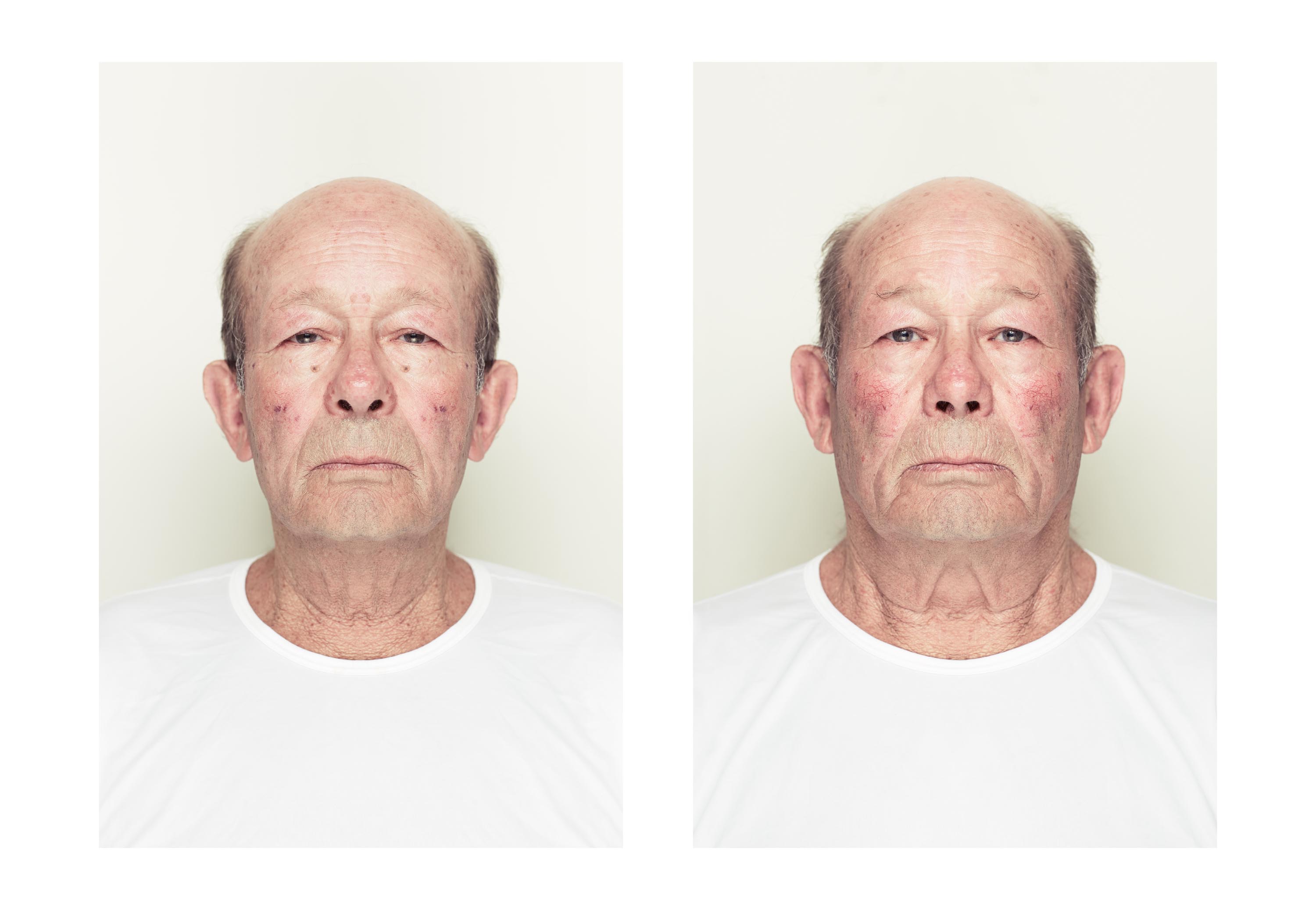 The Two Sides of One Person's Face, turned into one person